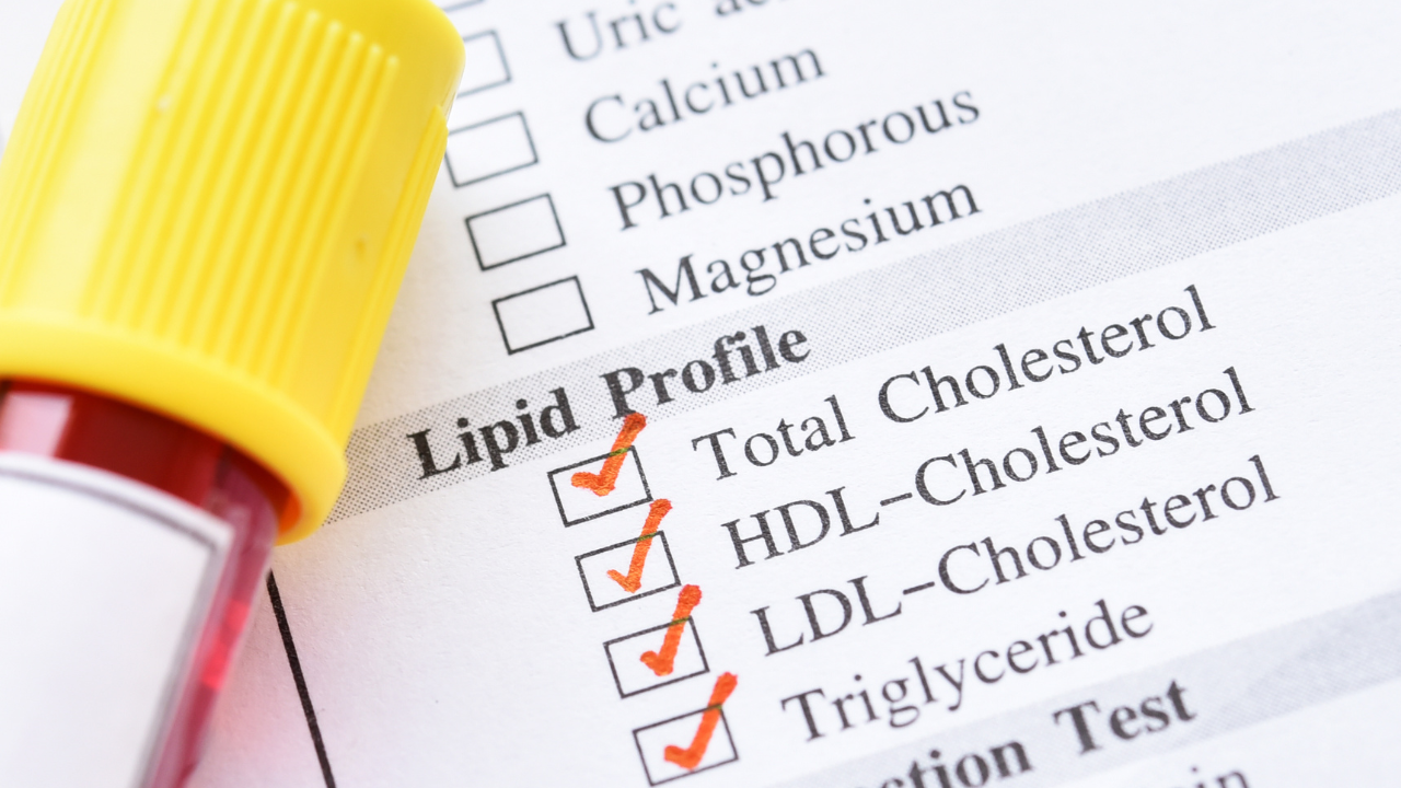 How a Lipid Profile Test Can Help Prevent Heart Disease